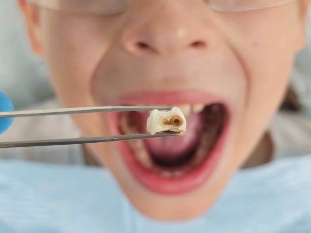  Nevada, MO Emergency Dentist Pros