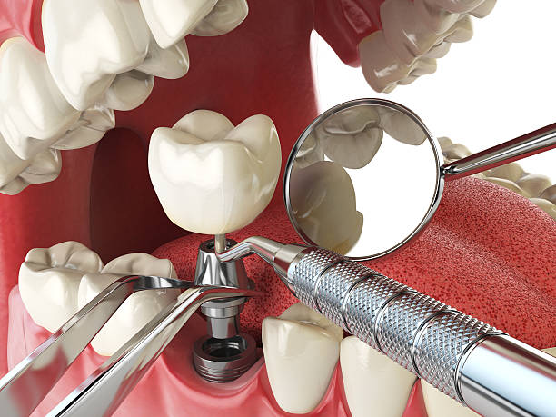 , MO Emergency Dentist Company